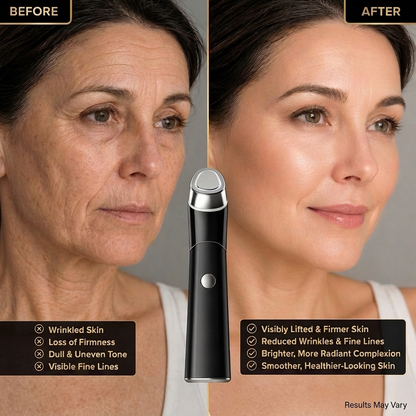 GlowLift 4-in-1 Facial Device